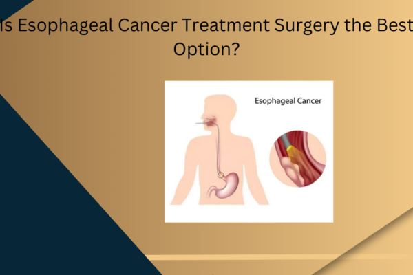 esophageal cancer treatment surgery